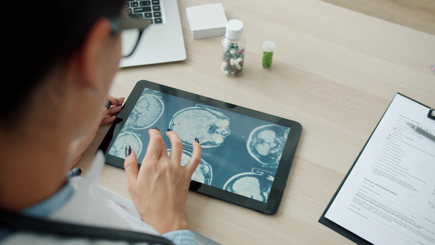 Doctor reviewing brain scans on a tablet at a desk.